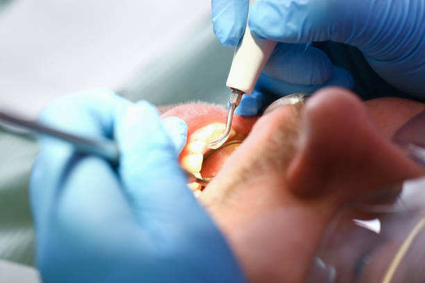 Best Urgent Tooth Repair  in Locust Valley, NY